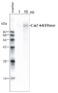 Ca2+-ATPase | Calmodulin-stimulated calcium-ATPase in the group Antibodies Plant/Algal / Membrane Transport System / Plasma membrane at Agrisera AB (Antibodies for research) (AS09 486)